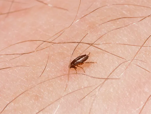 Dedetização de Pulgas em São Rafael